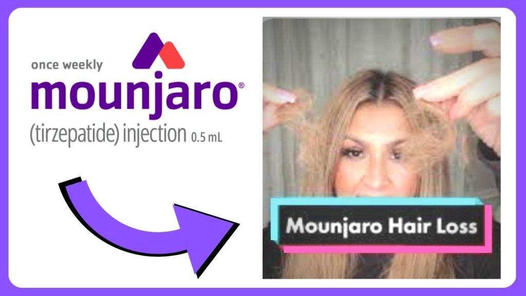 Does Mounjaro Cause Hair Loss? The Truth Revealed! 2 mounjaro cause hair loss
